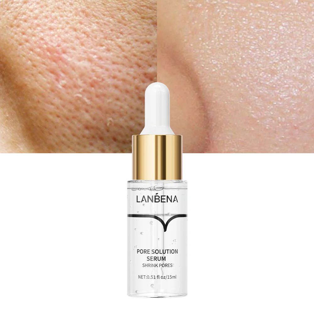 LANBENA Pore Solution Serum - Professional Blackhead & Pore Treatment